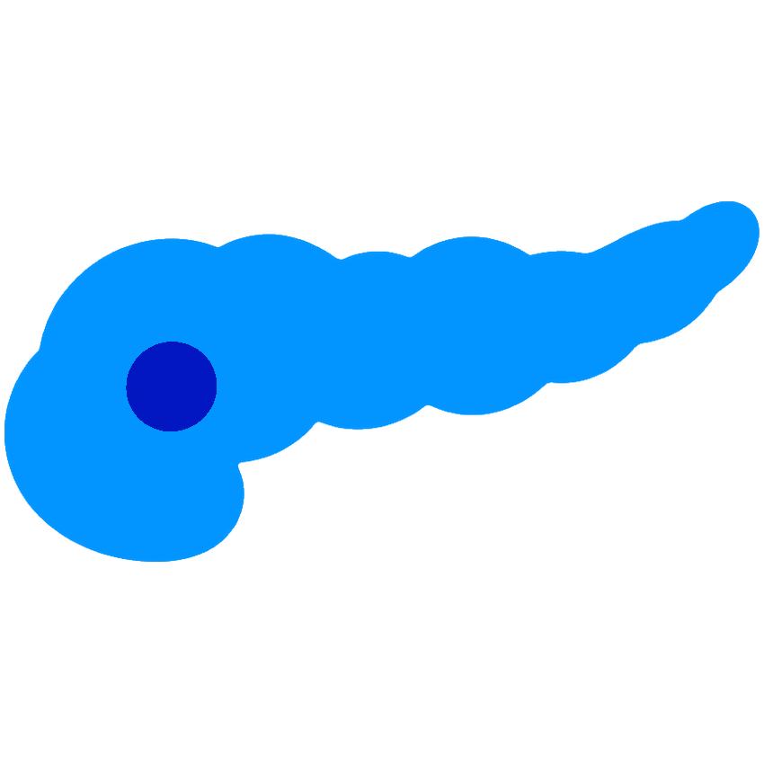 胰腺癌